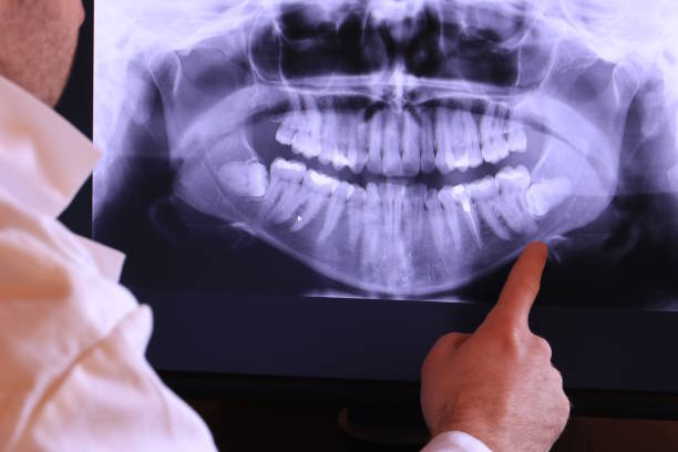 Best Emergency Dental Surgery in Cary, IL