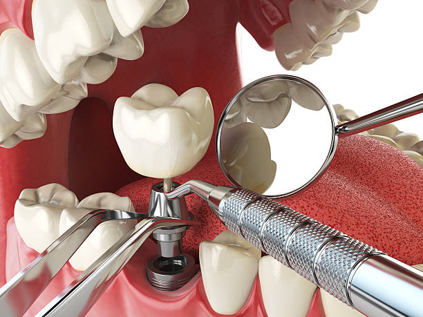 Best Walk-In Emergency Dentist in Cary, IL